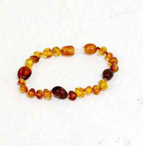 Light and Dark Cognac Amber Bracelet/Anklet